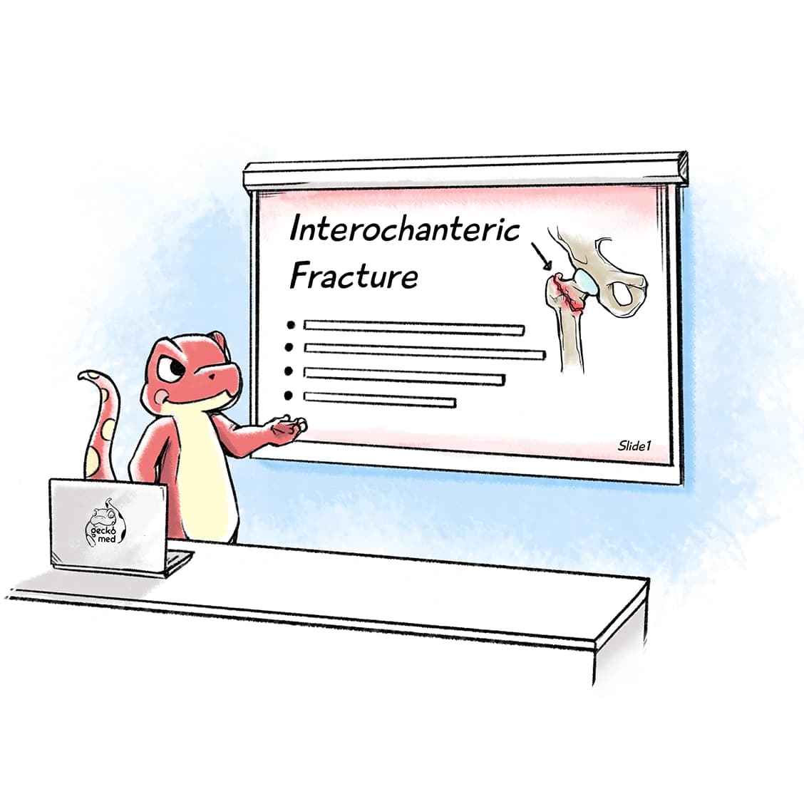 Intertrochanteric Fractures: Management and Considerations (With PPT)