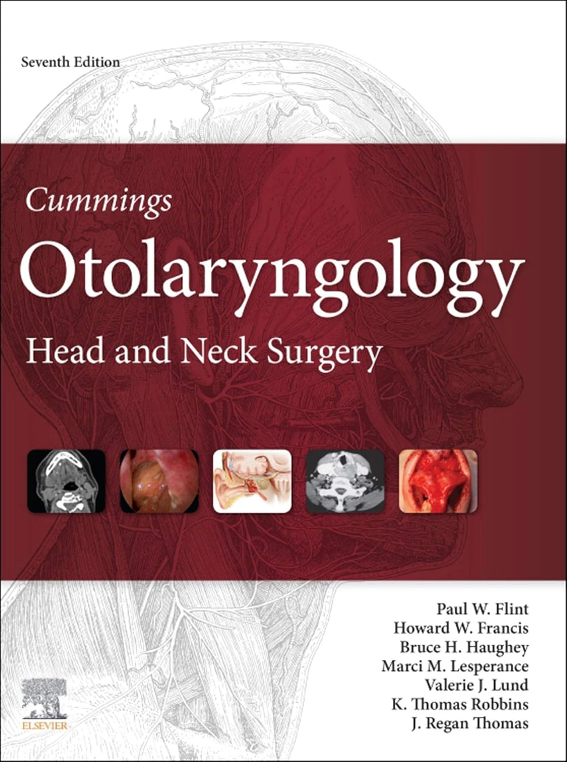 Cummings Otolaryngology Head Neck Surgery