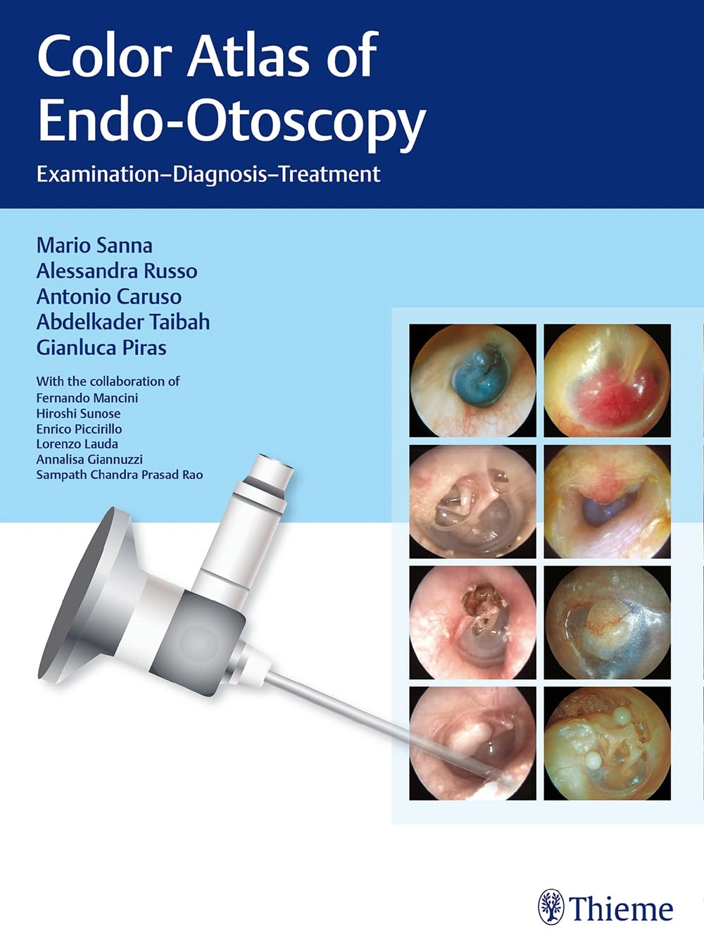 Color Atlas Endo Otoscopy