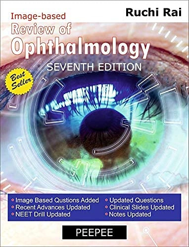 Review Ophthalmology