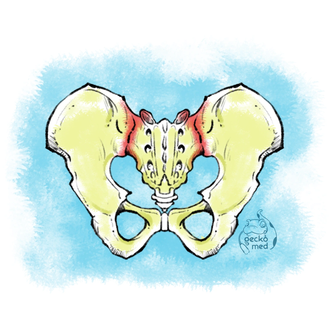 Sacroiliac Joint Fracture